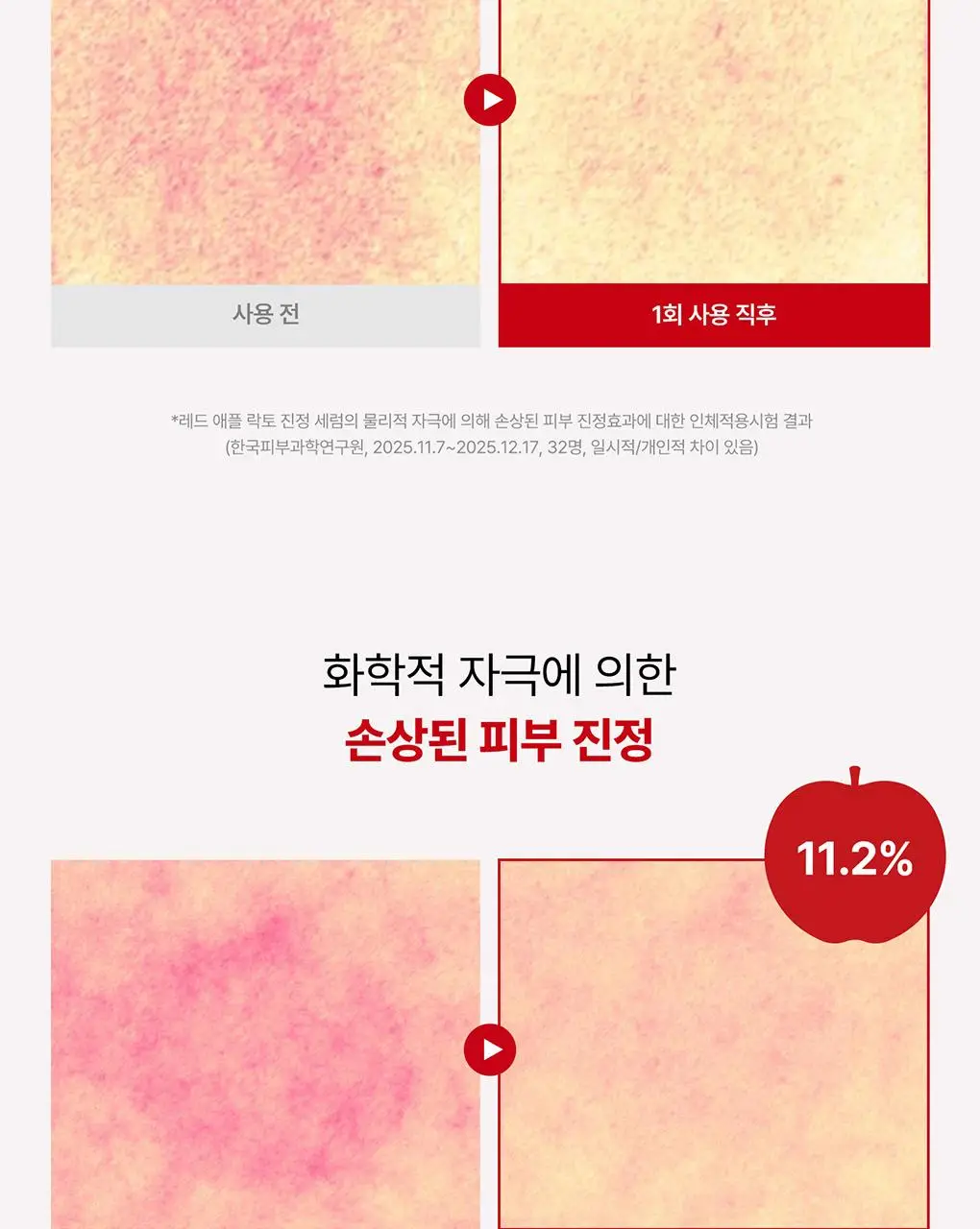 [NEW/단독기획] rdrd 레드 애플 락토 진정 세럼 30ml 응급진정 KIT 기획 상세페이지 27